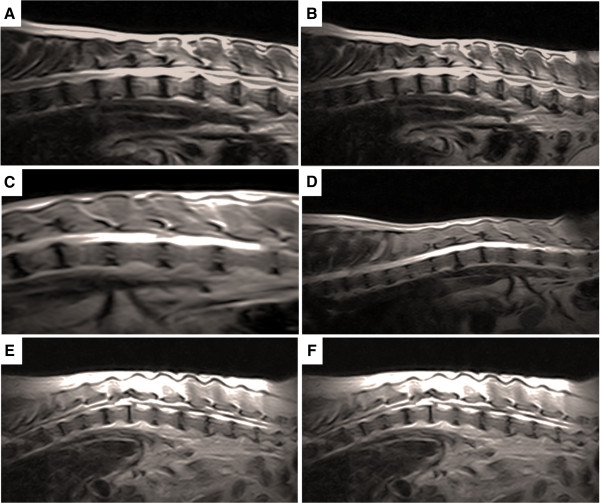 Pilot study: bone marrow stem cells as a treatment for dogs with chronic spinal cord injury.