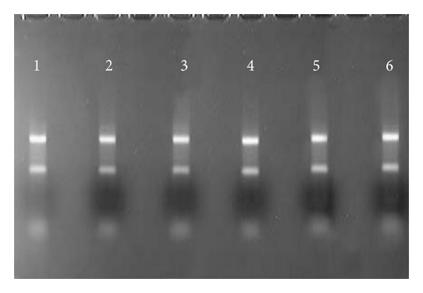 Thyroid hormone status interferes with estrogen target gene expression in breast cancer samples in menopausal women.