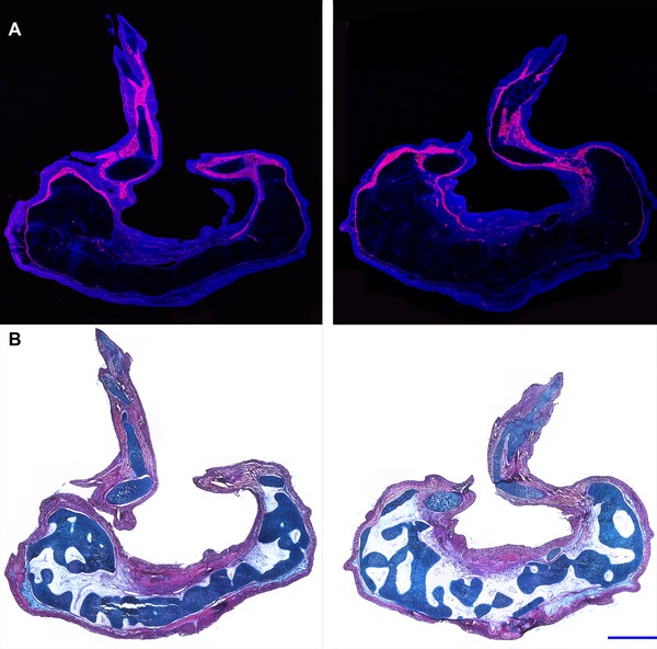 Position-specific induction of ectopic limbs in non-regenerating blastemas on axolotl forelimbs.