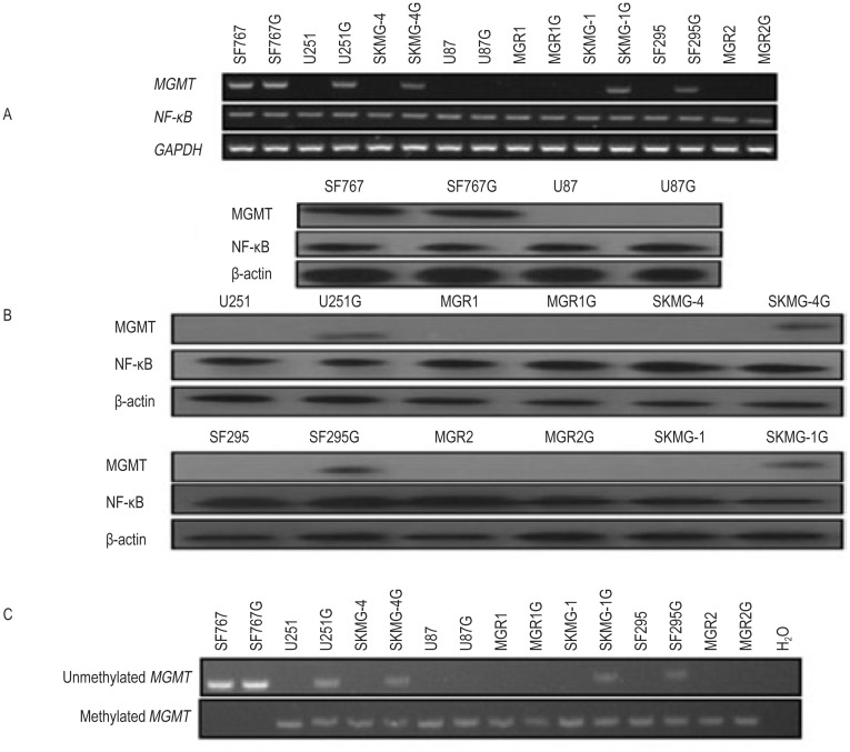 Enhanced MGMT expression contributes to temozolomide resistance in glioma stem-like cells.