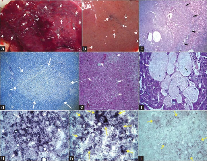 Antisense oligonucleotides directed against insulin-like growth factor-II messenger ribonucleic acids delay the progress of rat hepatocarcinogenesis.