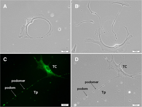 Human lung telocytes could promote the proliferation and angiogenesis of human pulmonary microvascular endothelial cells in vitro.