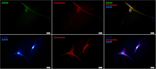 Human lung telocytes could promote the proliferation and angiogenesis of human pulmonary microvascular endothelial cells in vitro.