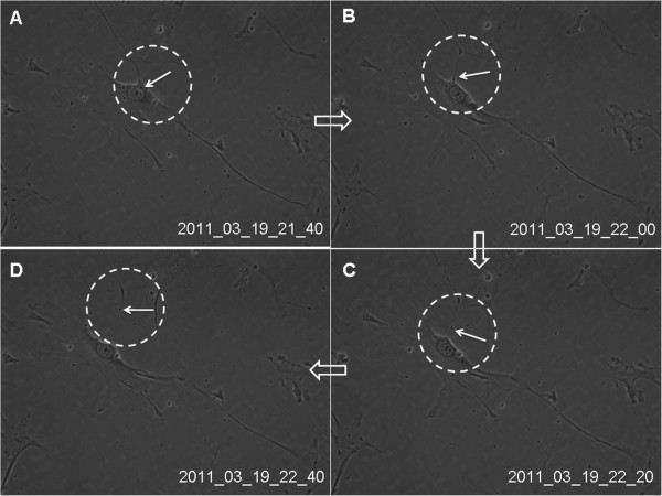 Human lung telocytes could promote the proliferation and angiogenesis of human pulmonary microvascular endothelial cells in vitro.