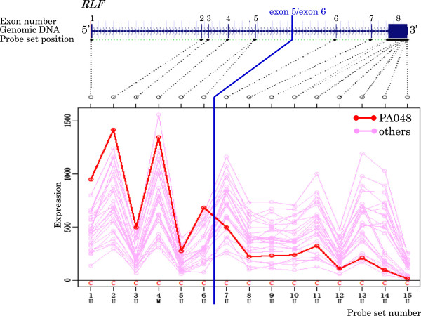 Development of detection method for novel fusion gene using GeneChip exon array.