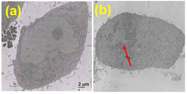 Investigation of nanoscale structural alterations of cell nucleus as an early sign of cancer.