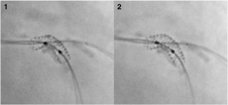 Efficacy of non-compliant balloon post-dilation in optimization of contemporary stents: A digital stent enhancement study