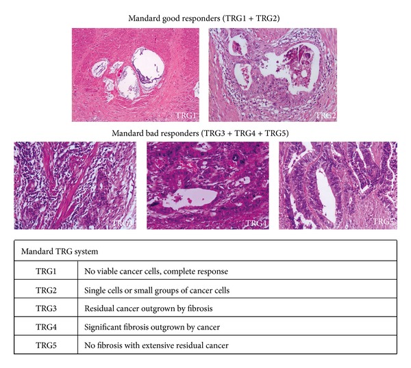 Prognostic value of mandard and dworak tumor regression grading in rectal cancer: study of a single tertiary center.