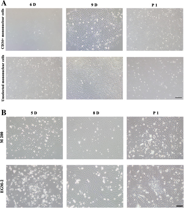 Isolation and characterization of endothelial progenitor cells from Rhesus monkeys.