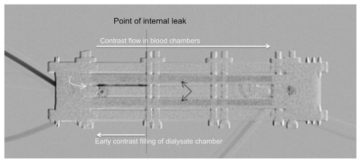 Imaging assessment of a portable hemodialysis device: detection of possible failure modes and monitoring of functional performance.