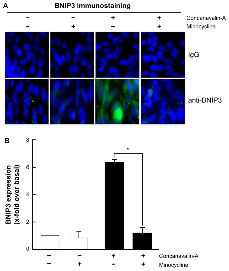 Tetracycline derivative minocycline inhibits autophagy and inflammation in concanavalin-a-activated human hepatoma cells.