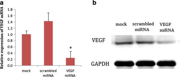 Effect of the vascular endothelial growth factor expression level on angiopoietin-2-mediated nasopharyngeal carcinoma growth.