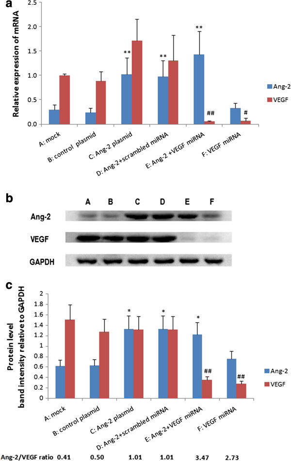 Effect of the vascular endothelial growth factor expression level on angiopoietin-2-mediated nasopharyngeal carcinoma growth.