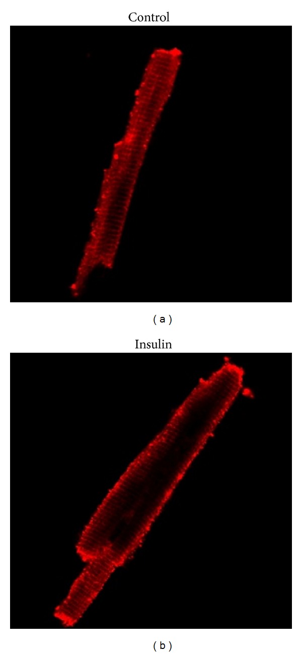 Expression and regulation of facilitative glucose transporters in equine insulin-sensitive tissue: from physiology to pathology.