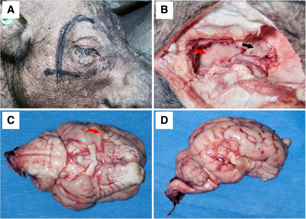 Development and characterization of a Yucatan miniature biomedical pig permanent middle cerebral artery occlusion stroke model.