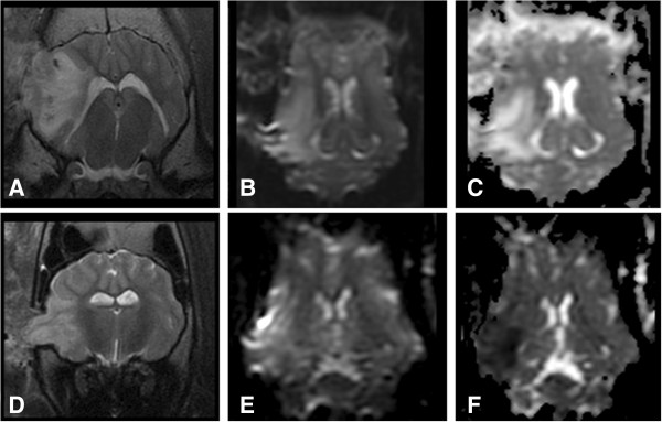 Development and characterization of a Yucatan miniature biomedical pig permanent middle cerebral artery occlusion stroke model.