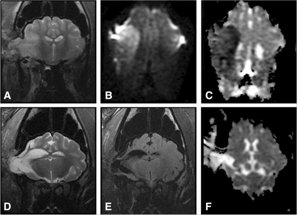 Development and characterization of a Yucatan miniature biomedical pig permanent middle cerebral artery occlusion stroke model.