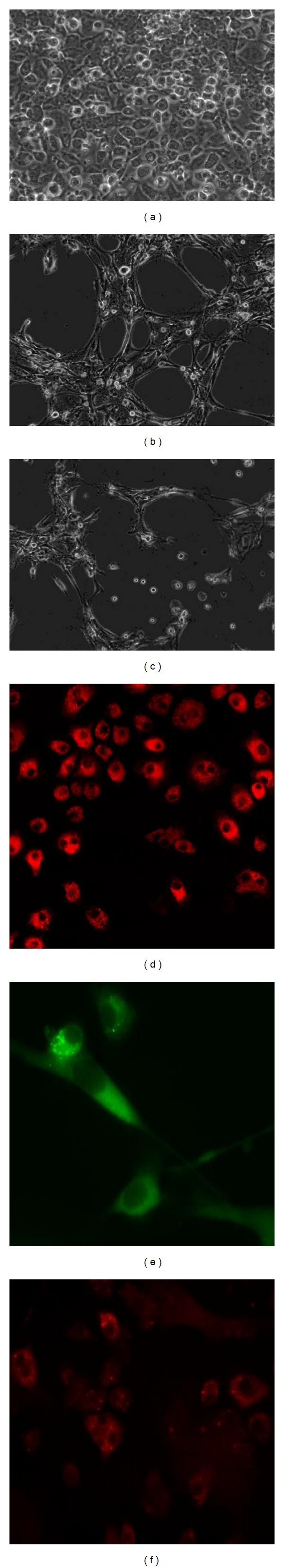 Mouse bone marrow-derived endothelial progenitor cells do not restore radiation-induced microvascular damage.