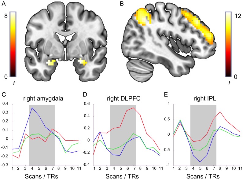 The impact of stimulus valence and emotion regulation on sustained brain activation: task-rest switching in emotion.