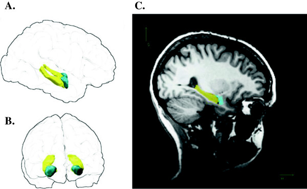 The Behavioural Inhibition System, anxiety and hippocampal volume in a non-clinical population.