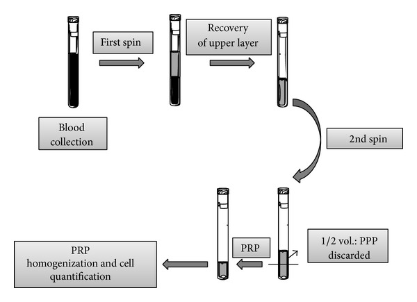 Relevant aspects of centrifugation step in the preparation of platelet-rich plasma.