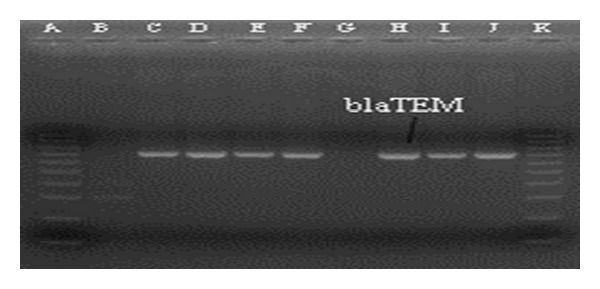 Emergence of bla TEM Type Extended-Spectrum β -Lactamase Producing Salmonella spp. in the Urban Area of Bangladesh.