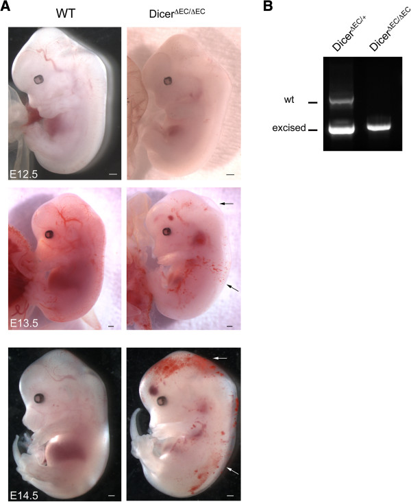 The role of RNA interference in the developmental separation of blood and lymphatic vasculature.