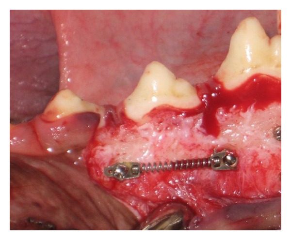 Effect of healing time on bone-implant contact of orthodontic micro-implants: a histologic study.