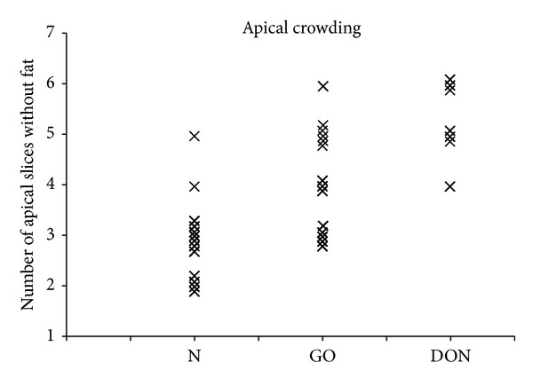 Orbital Volumetry in Graves' Orbitopathy: Muscle and Fat Involvement in relation to Dysthyroid Optic Neuropathy.