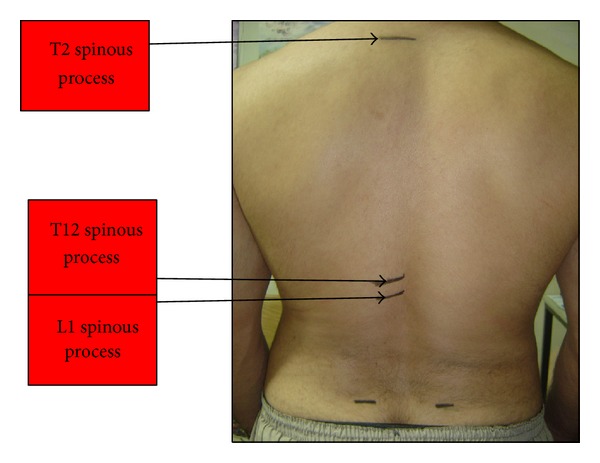 Normal range of thoracic kyphosis in male school children.