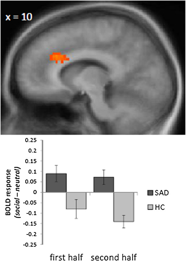Area-dependent time courses of brain activation during video-induced symptom provocation in social anxiety disorder.