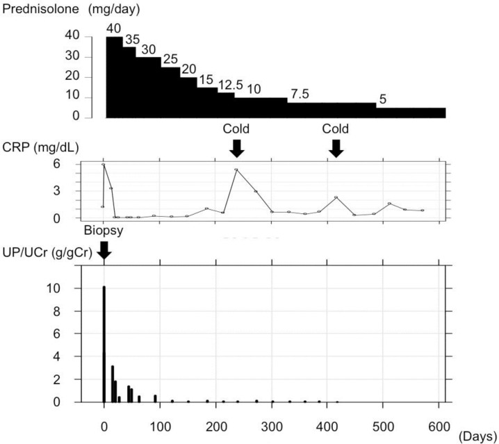 A Case of Membranous Glomerulonephropathy Associated with Takayasu's Arteritis.