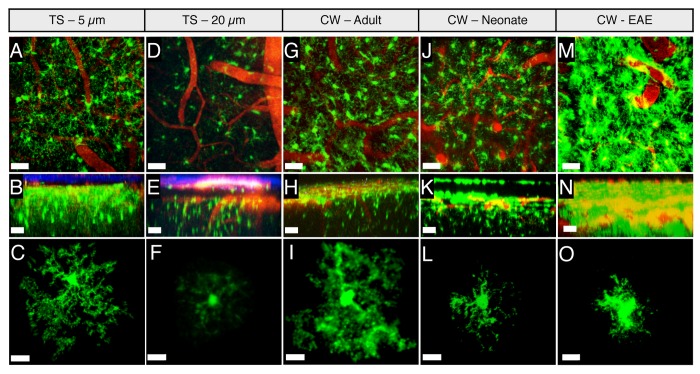 Comparison of intravital thinned skull and cranial window approaches to study CNS immunobiology in the mouse cortex.