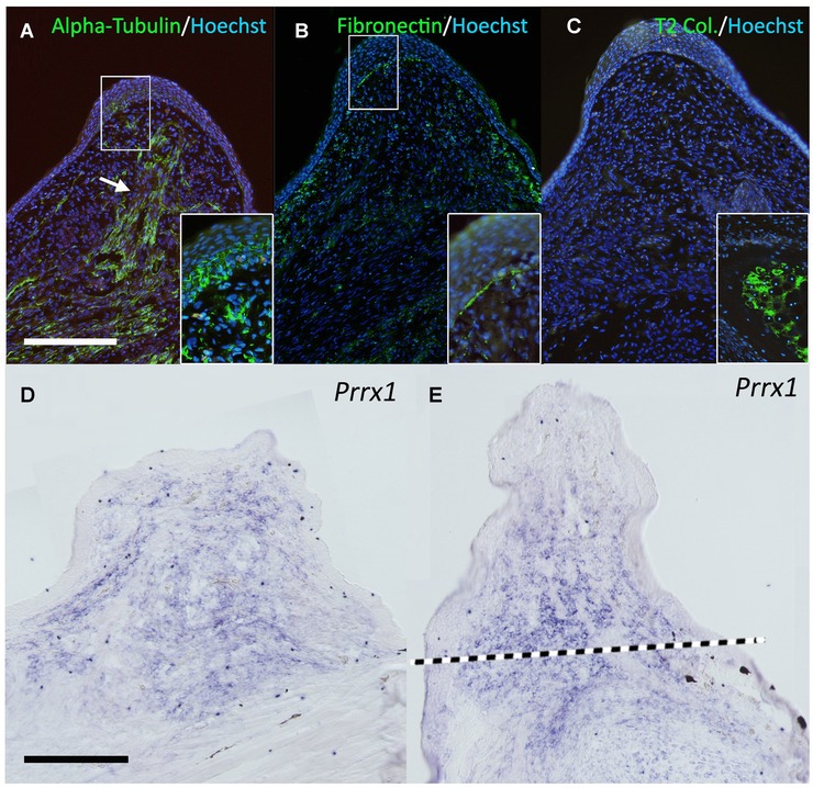 Ectopic blastema induction by nerve deviation and skin wounding: a new regeneration model in Xenopus laevis.