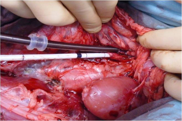 Development of a preclinical model of donation after circulatory determination of death for translational application.