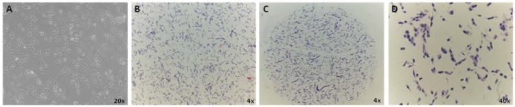 Application of Tissue Microarray Technology to Stem Cell Research.