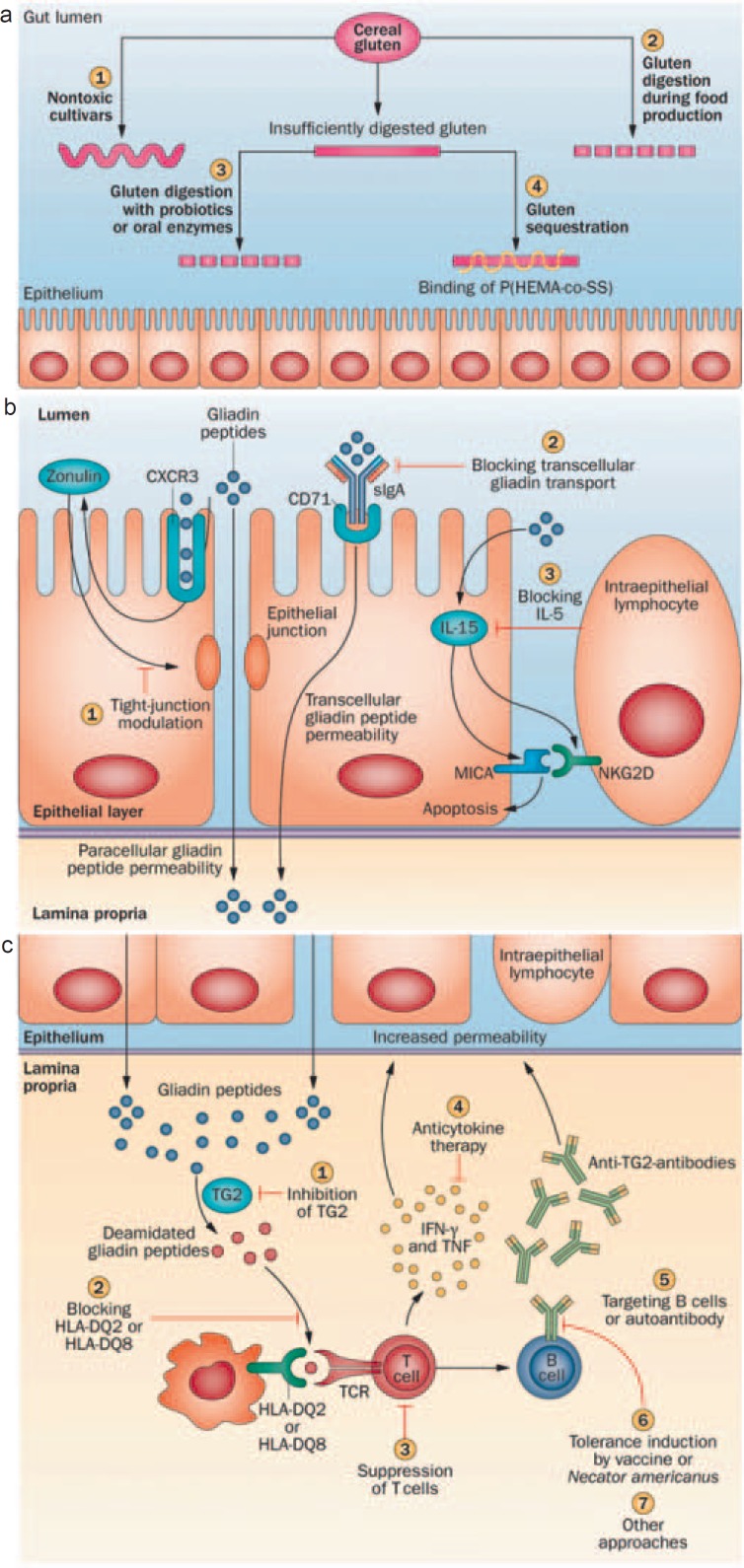 Coeliac Disease - New Pathophysiological Findings and Their Implications for Therapy.