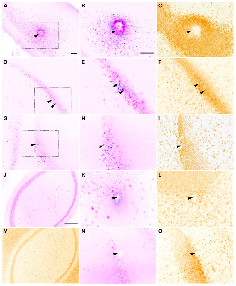 Deep brain stimulation macroelectrodes compared to multiple microelectrodes in rat hippocampus.
