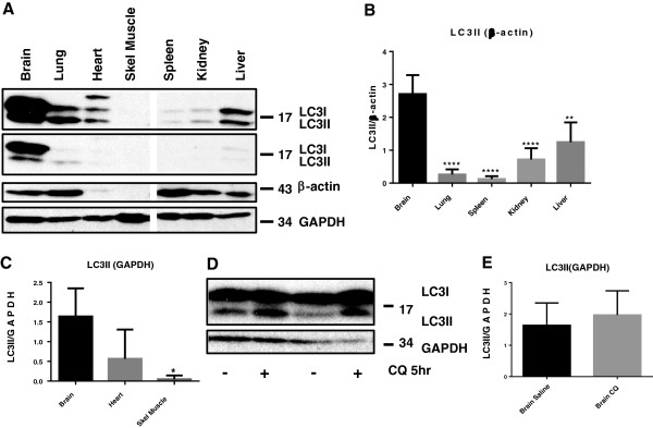 Rapamycin up-regulation of autophagy reduces infarct size and improves outcomes in both permanent MCAL, and embolic MCAO, murine models of stroke.