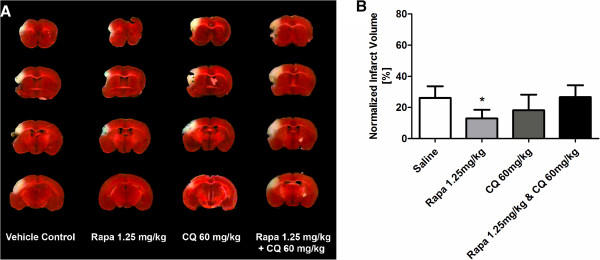 Rapamycin up-regulation of autophagy reduces infarct size and improves outcomes in both permanent MCAL, and embolic MCAO, murine models of stroke.