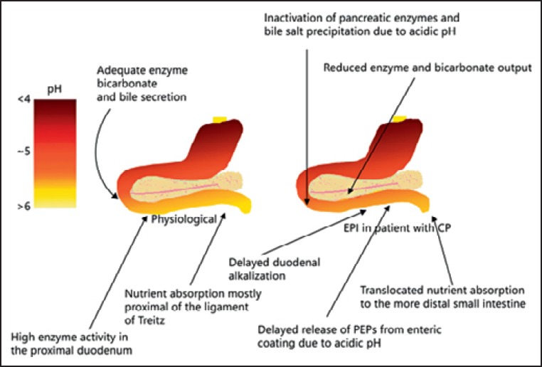 The Pancreas: Causes for Malabsorption.