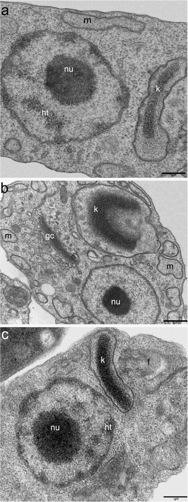 Effects of camptothecin derivatives and topoisomerase dual inhibitors on Trypanosoma cruzi growth and ultrastructure.