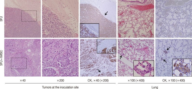 Mesenchymal stromal cells promote tumor progression in fibrosarcoma and gastric cancer cells.