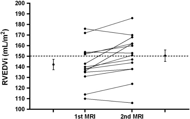 Progress of right ventricular dilatation in adults with repaired tetralogy of Fallot and free pulmonary regurgitation