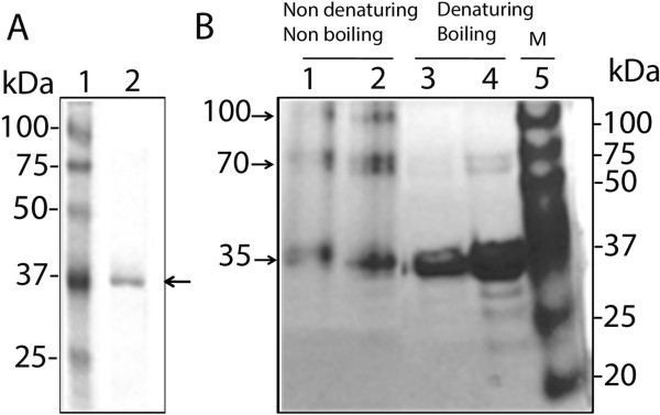 Structural characterization and subcellular localization of Drosophila organic solute carrier partner 1.