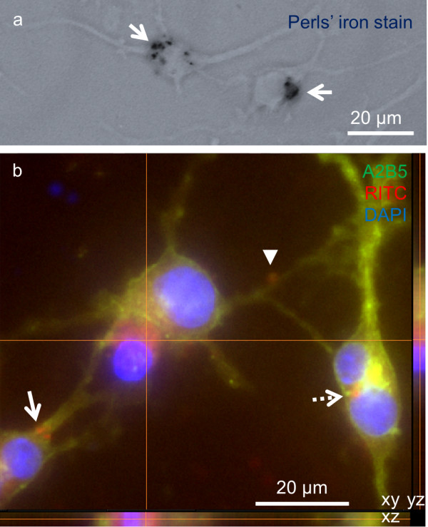 Magnetic nanoparticles for oligodendrocyte precursor cell transplantation therapies: progress and challenges.