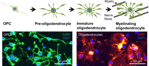 Magnetic nanoparticles for oligodendrocyte precursor cell transplantation therapies: progress and challenges.
