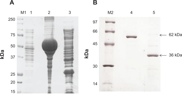 Molecular and Kinetic Characterization of Babesia microti Gray Strain Lactate Dehydrogenase as a Potential Drug Target.