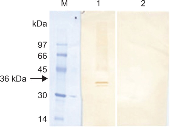 Molecular and Kinetic Characterization of Babesia microti Gray Strain Lactate Dehydrogenase as a Potential Drug Target.