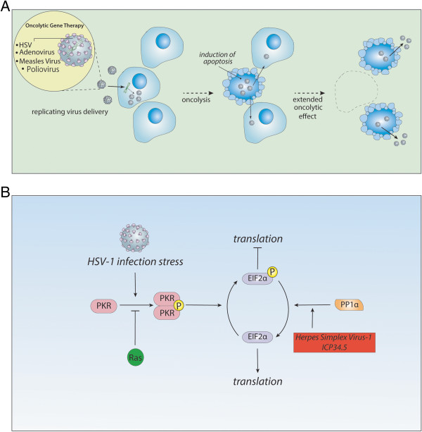 Gene therapy for malignant glioma.